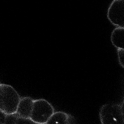Cell Segmentation from Membrane Staining for Plant Tissues