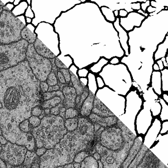Neuron Segmentation in 2D EM (Membrane)