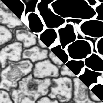 Neuron Segmentation in EM (Membrane Prediction)