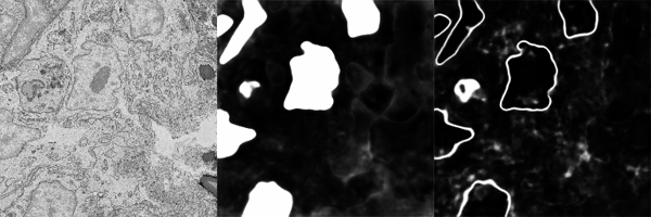 PlatynereisEMnucleiSegmentationBoundaryModel