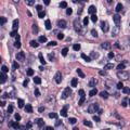 StarDist H&E Nuclei Segmentation