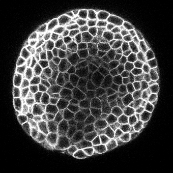3D UNet Arabidopsis Apical Stem Cells