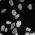 StarDist Fluorescence Nuclei Segmentation