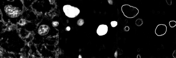 EnhancerMitochondriaEM2D