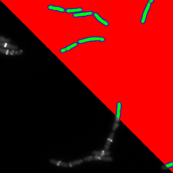 B. Sutilist bacteria segmentation - Widefield microscopy - 2D UNet