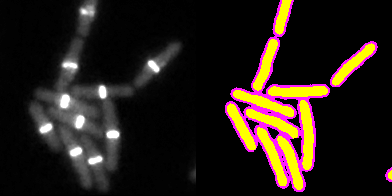 B. Sutilist bacteria segmentation - Widefield microscopy - 2D UNet